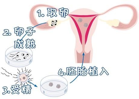 关于代生儿子机构